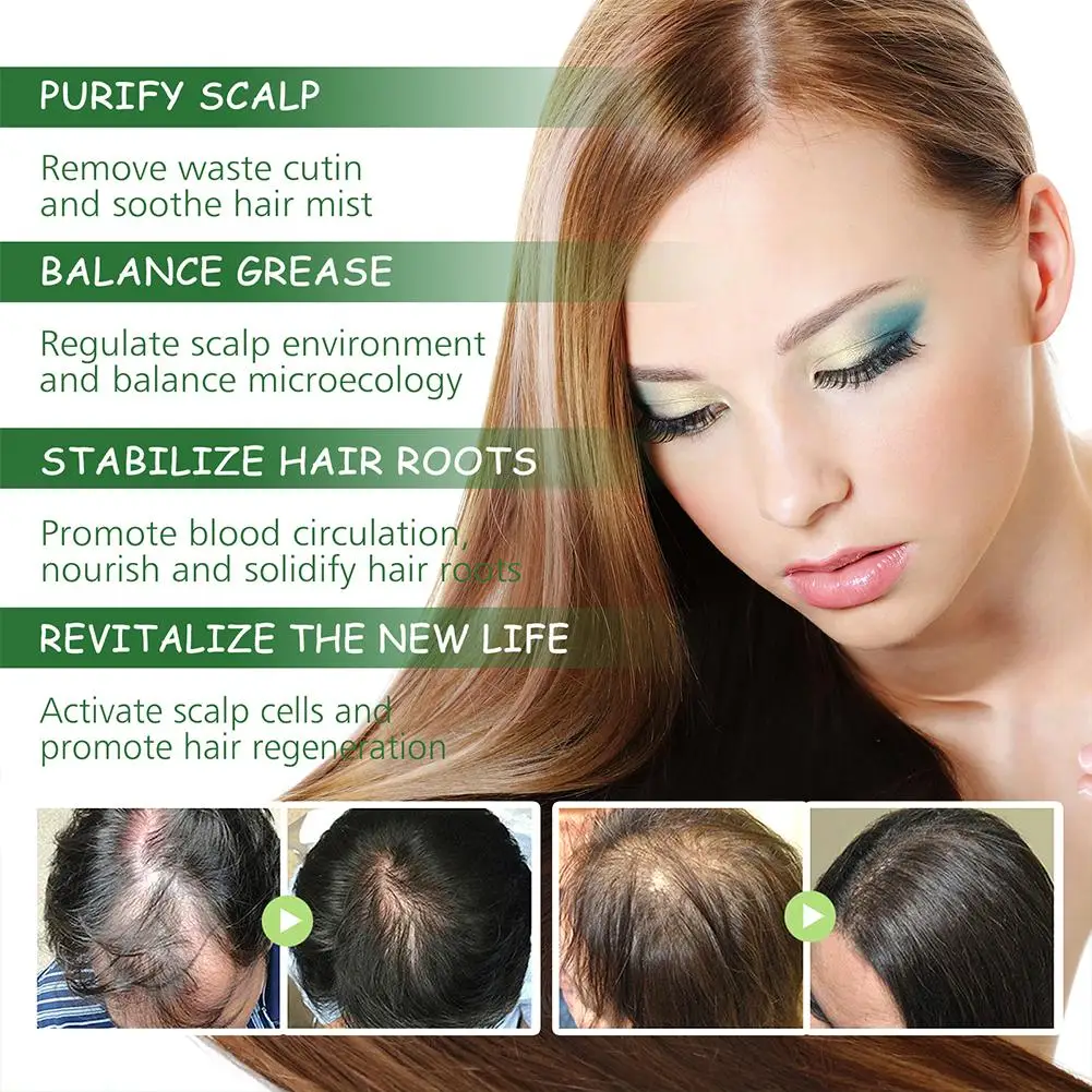 Minyak esensial Perawatan Rambut Rosemary memelihara akar rambut bifurkasi Serum perawatan rambut padat memperbaiki rambut