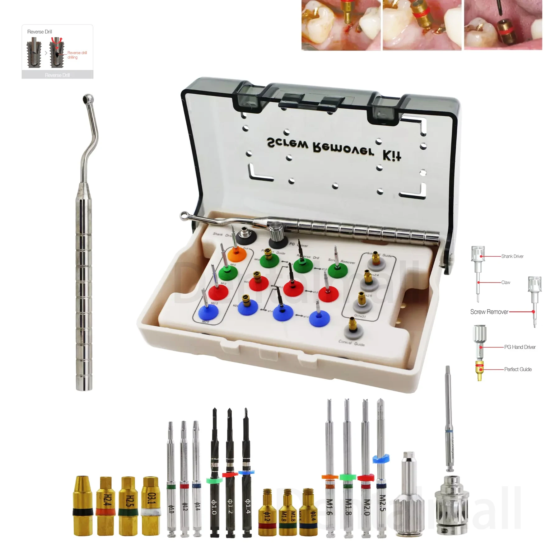 

Dental Implant Screw Removal Drivers Kit Instrument Surgical Remover Drill Tool NeoBiotech