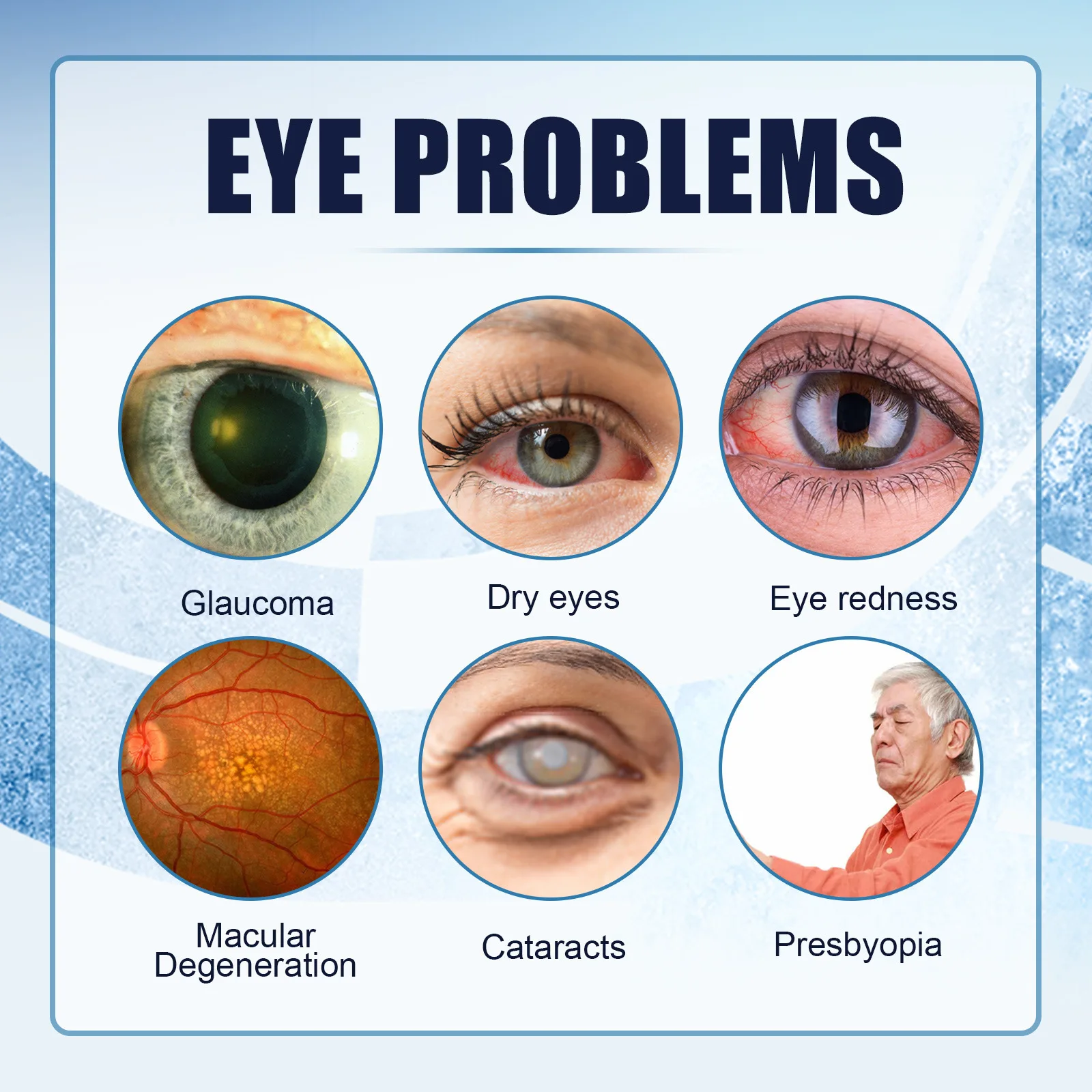 13gEye drops used for cataracts, blurred vision, and glaucoma conjunctivitis to alleviate visual impairment ,reduce inflammation