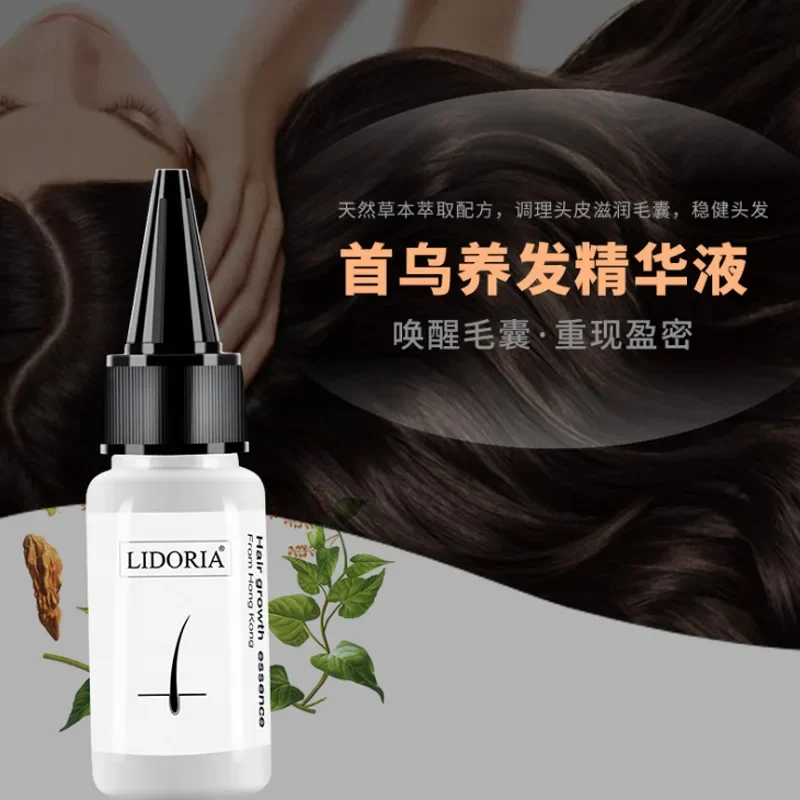 Hair Growth Care Essence Oil Plant Nutrient Liquid UFA Natural Herb Anti-offset Prevent Hair Loss  Beauty Health  Hair Sprays