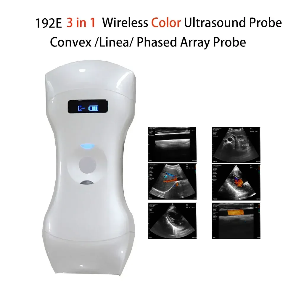 Wireless Color Ultrasound Probe Scanner Portable Liner Convex for Pregnancy, Blood Vessels Ligaments, Nerves, Muscles