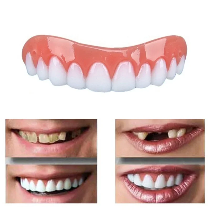 

Denture Silicone Kit Adjustable Snap-in Denture Set Teeth Braces Bracket Temporary Tooth Decoration Model Dental ck848