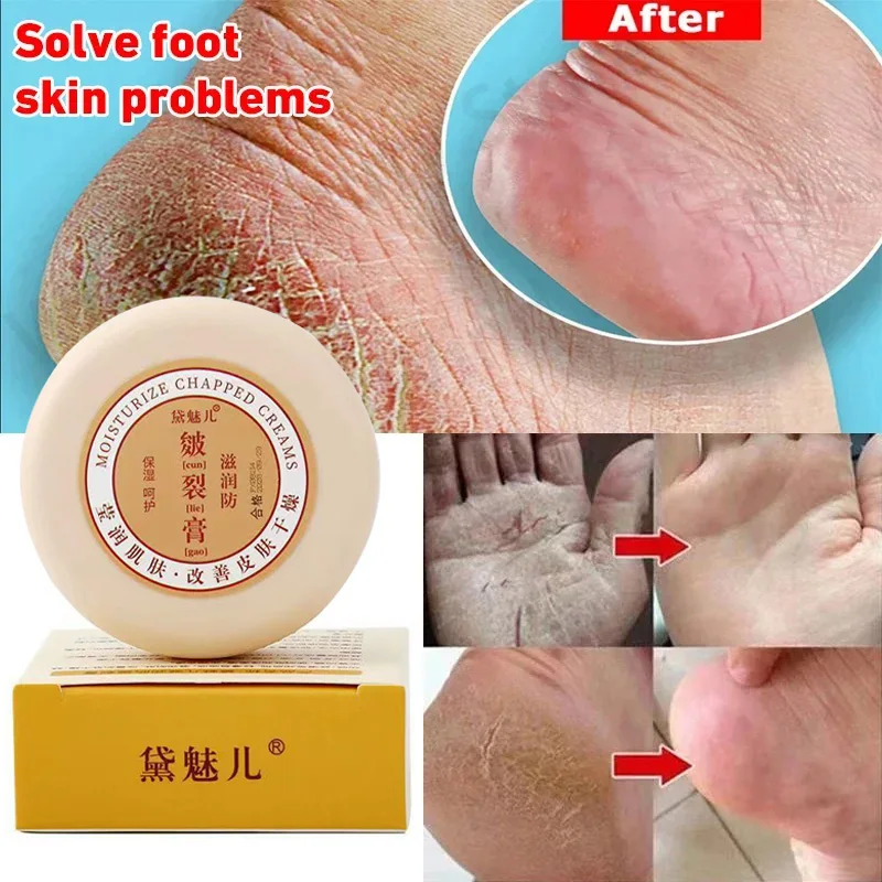 

Anti-drying Crack Foot Cream Heel Cracked Repair Cream Mask Oil Moisturizing Removal Dead Skin Hand Feet Smooth Care Product