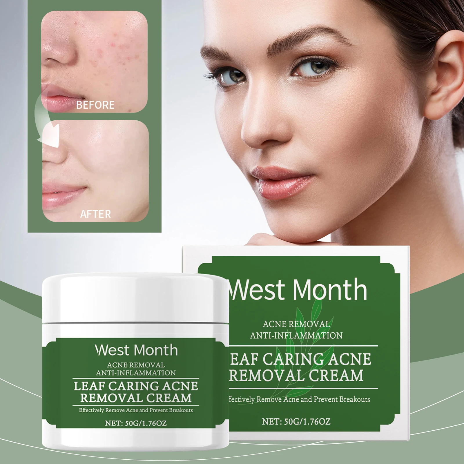 

West&Month Soothing Acne Cream Moisturizes and Maintains Moisture Improves Skin Removes Acne and Blackheads and Refines Pores