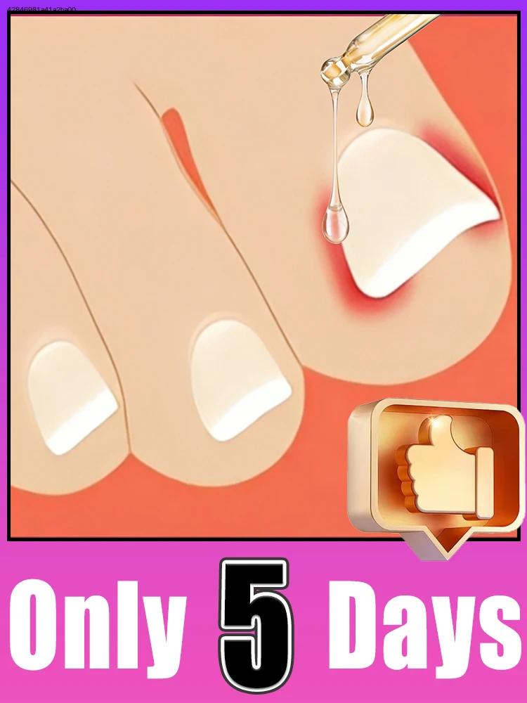 

Dɪᴛᴄʜ ᴅʀʏ ᴄʜᴀᴘᴘᴇᴅ ᴄᴜᴛɪᴄʟᴇs, ғɪɴɢᴇʀᴛɪᴘs sᴛᴀʏ ʜʏᴅʀᴀᴛᴇᴅ ᴀɴᴅ sᴜᴘᴘʟᴇ