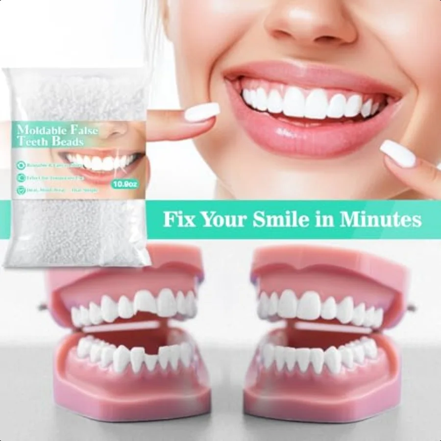 10,9 Unzen thermoplastische Prothesen-Kleberperlen, Zahnreparaturset, Reparatur von Prothesen, passend für thermoplastische Perlen zur Zahnfixierung, teilweise Prothese