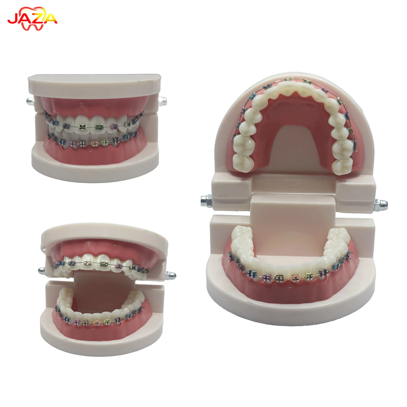 Detachable Orthodontic Dental Model with Metal Braces – Resin Teeth Demonstration Model for Dental Education & Patient Communic