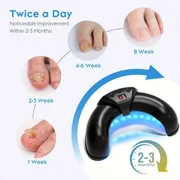 

1/2/4 Pcs Nail Fungus Light Device for Multiple Fingernails & Toenails