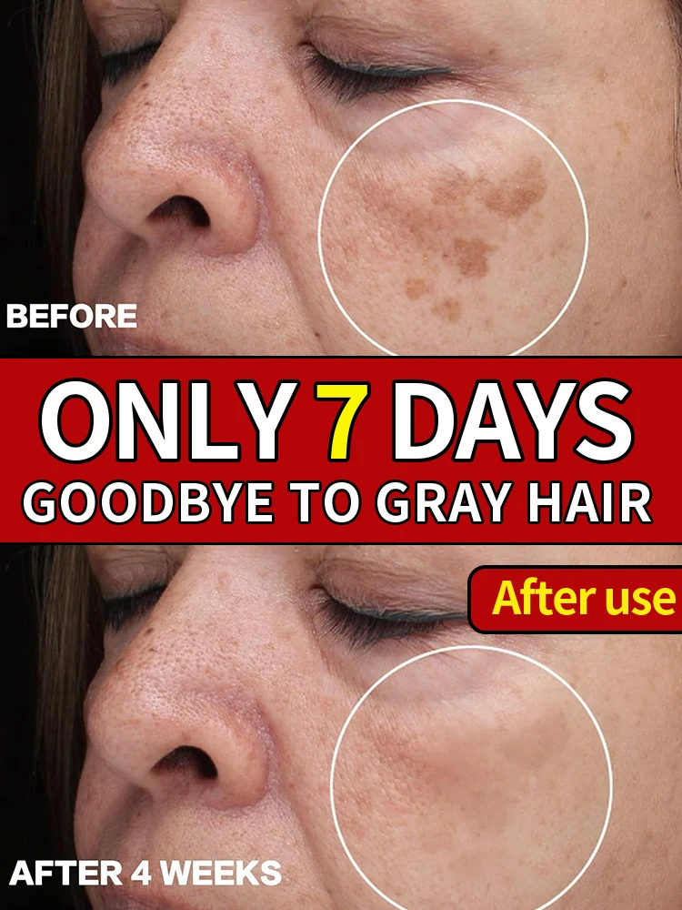 

Brighten your skin-Blemishes Essence for even skin tone