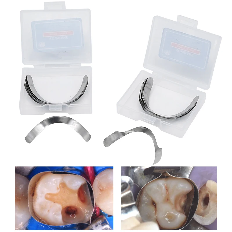 20Pcs/Bag Dental Matrix Bands Tofflemire Stuck Gingival Wall Lift Large Curvature Sectional Matrices Tooth Restorative