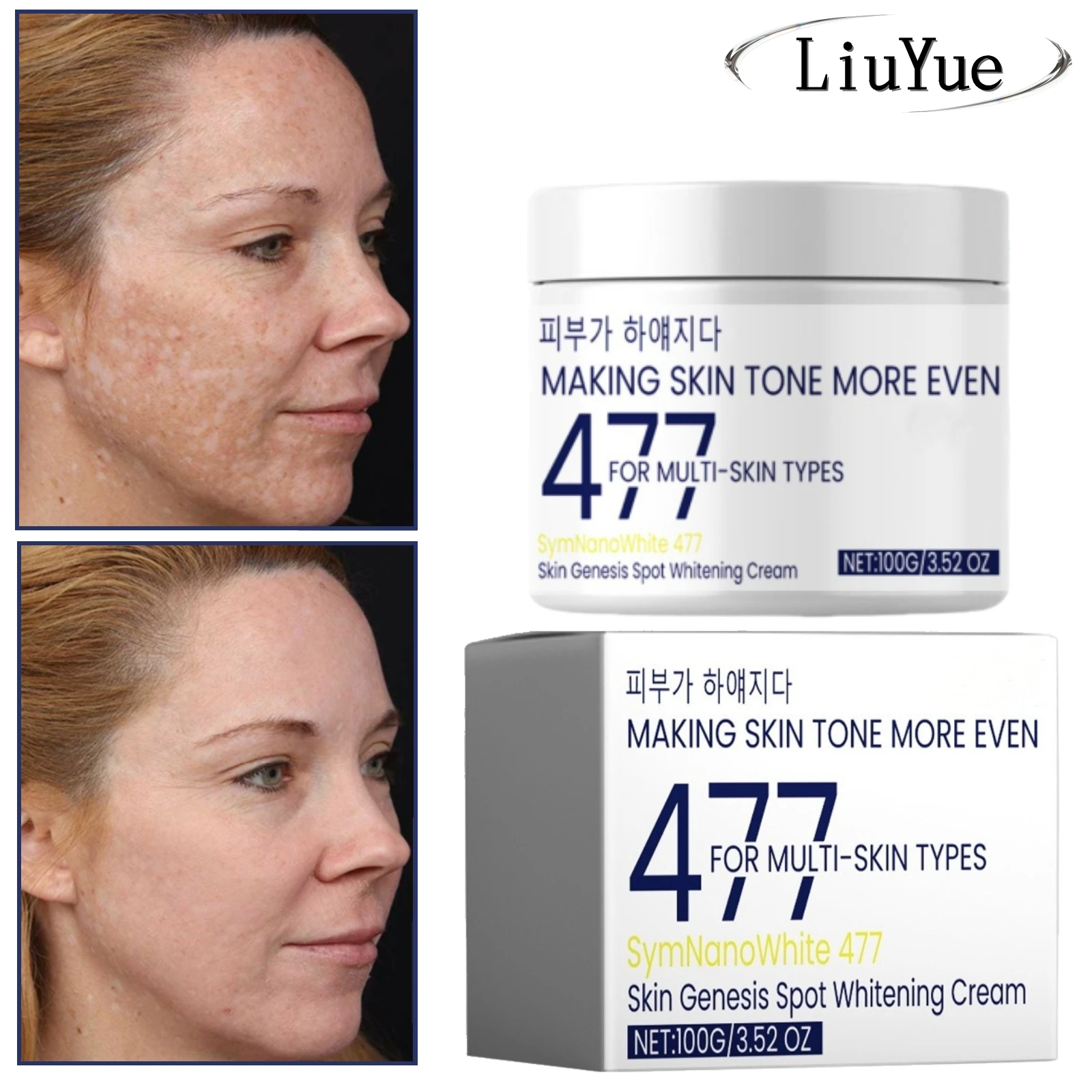 

Lighten Melasma Freckles Cream Face Dark Skin Brighten Removal Melanin Whiten&ing Moisturizing Cream Fade Spots Skin Care