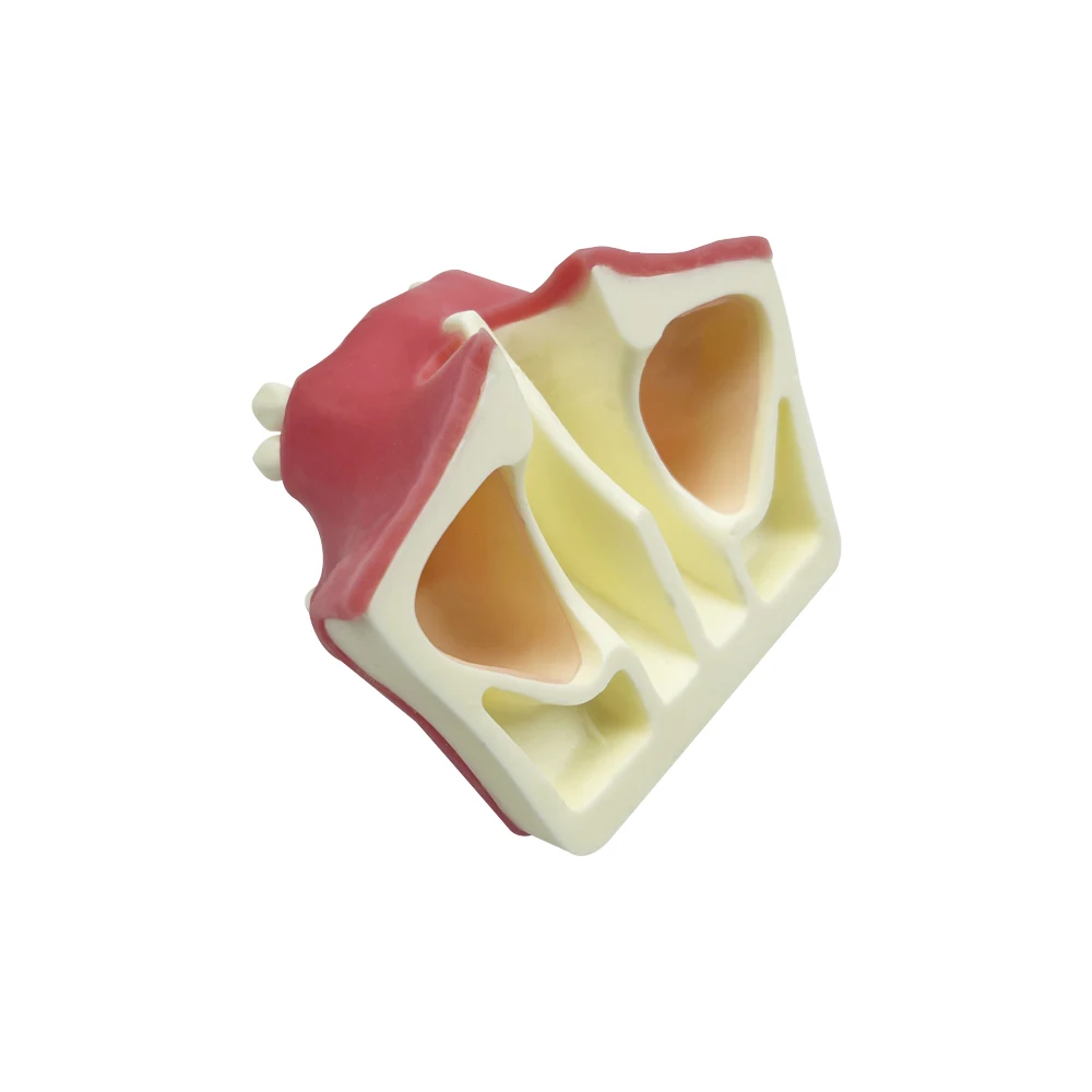 

1pc Maxillary Sinus Teeth Model Dental Implant Student Teaching Practice Model Upper Jaw Sinus Lift Implants Restoration Model