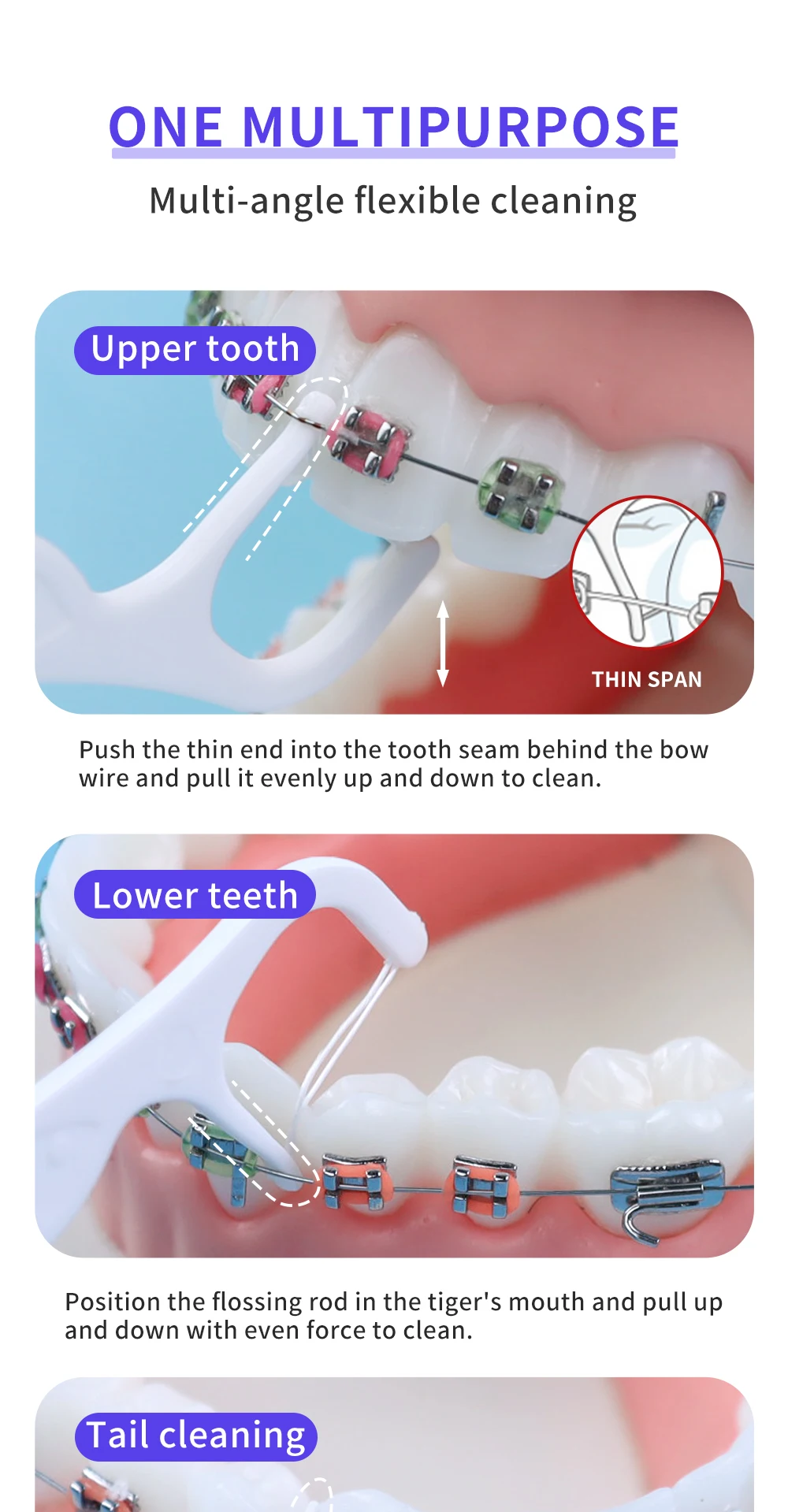 Kieferorthopädische Zahnseide-Sticks für Zahnspangen, Zahnstocher aus Kunststoff mit Gewinde, Doppellinien-Mundhalterungen, Interdentalbrosser-Picks – Detail 7