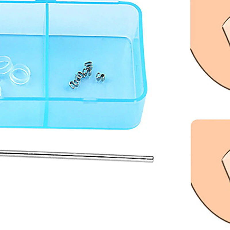 Ingrown Toenail Cor…