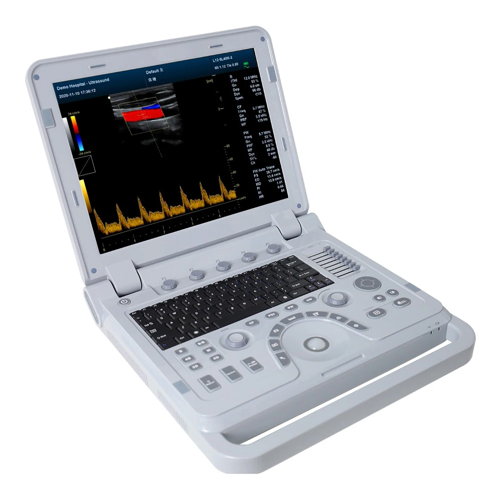 CONTEC CMS1700B Medical Professional Cardiology  Hospital 3D 4D color doppler ultrasound