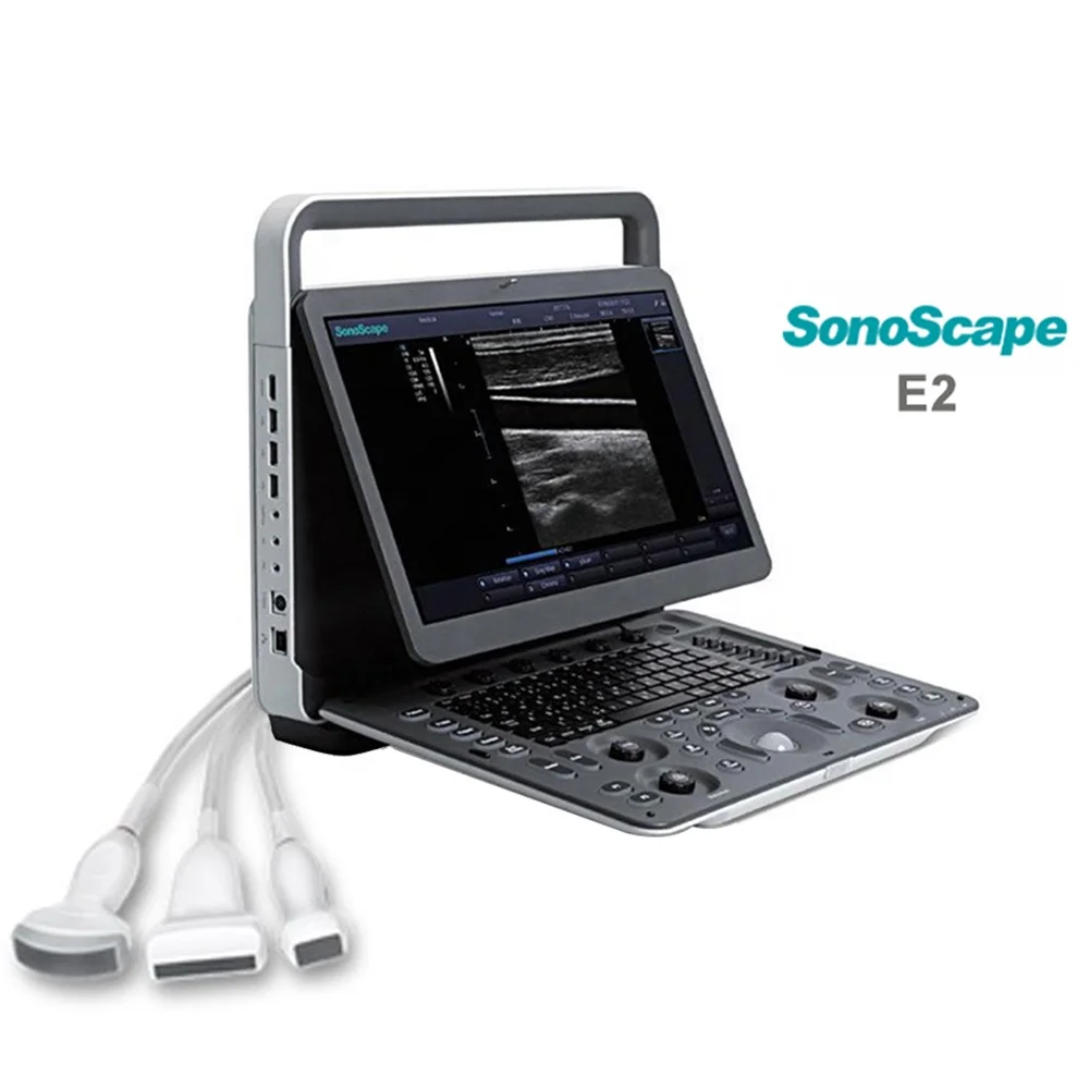 Products subject to negotiationMedical Instruments sonoscape E2 portable ultrasound Cheap price sonoscape ultrasound E2 Color