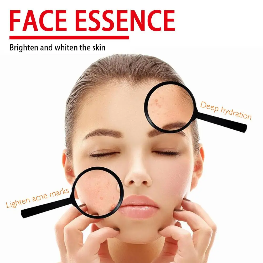 Vc Kojic Acid Serum Dark Spot Remover Even Skin Tone Brightening Gentle Soothing Hydrating Firming Facial Skin Care for Sensitiv