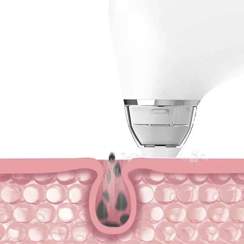 

%A For DOCO Pore Vacuum Cleaner Blackhead Remover Electric Acne Cleaner Pore Cleaner Machine Facial Beauty Clean Skin Tool