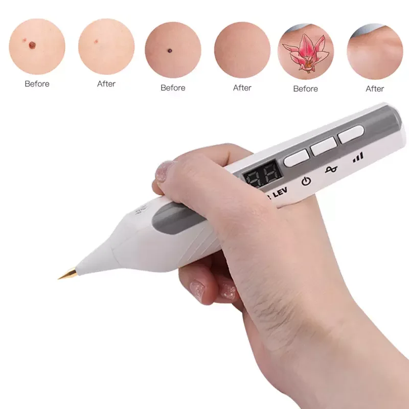 

Portable New LCD 9 Level Plasma Pen Freckle Remover Wart Tattoo Skin Tag Mole Removal Pen Home Salon Face Beauty Tools