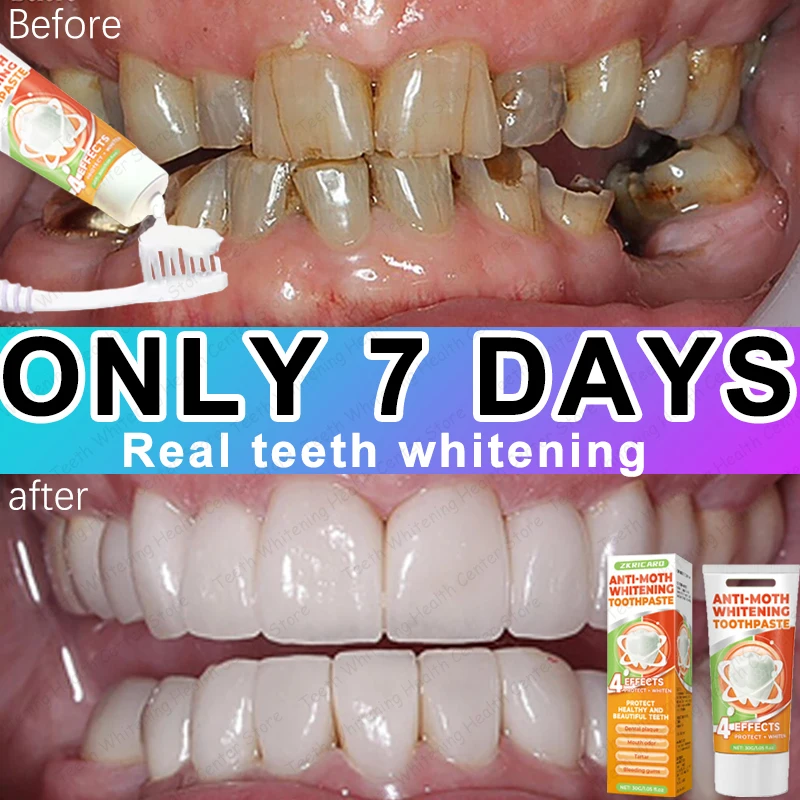 98% repurchase rate, you can have healthy teeth without teeth cleaning, recommended by dentists