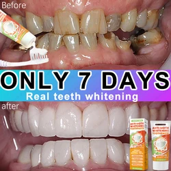 98% repurchase rate, you can have healthy teeth without teeth cleaning, recommended by dentists