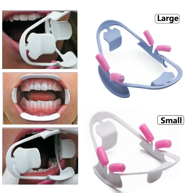 3D Oral Dental Mouth Opener Lip Retractor for Orthodontic and Dentistry Procedures