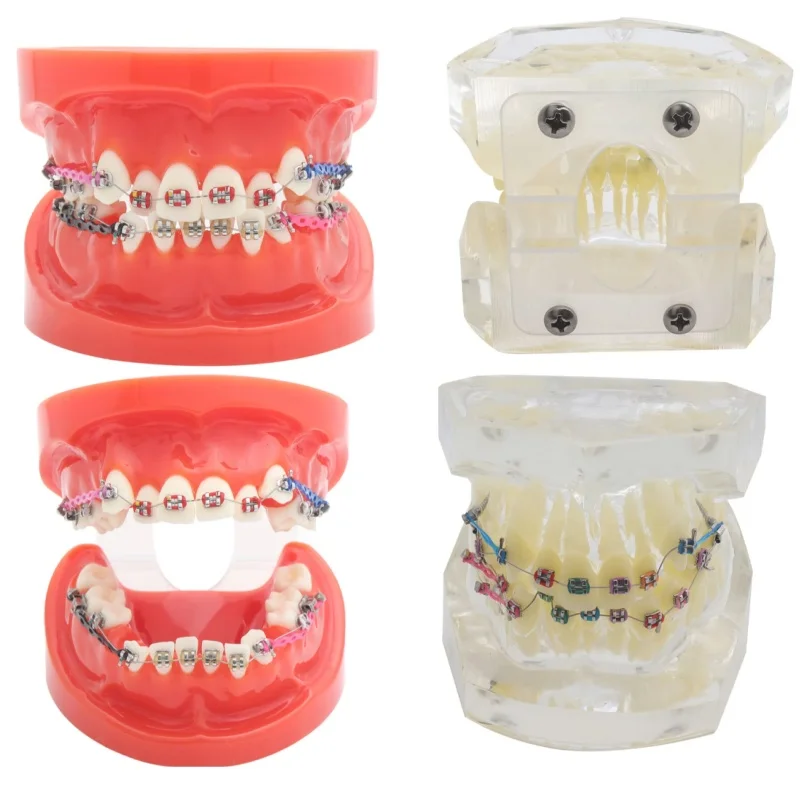 

Dental Teaching Model Metal Brackets Teeth Resources Model for Student Study Dentist Tool Restoration Correction Practice