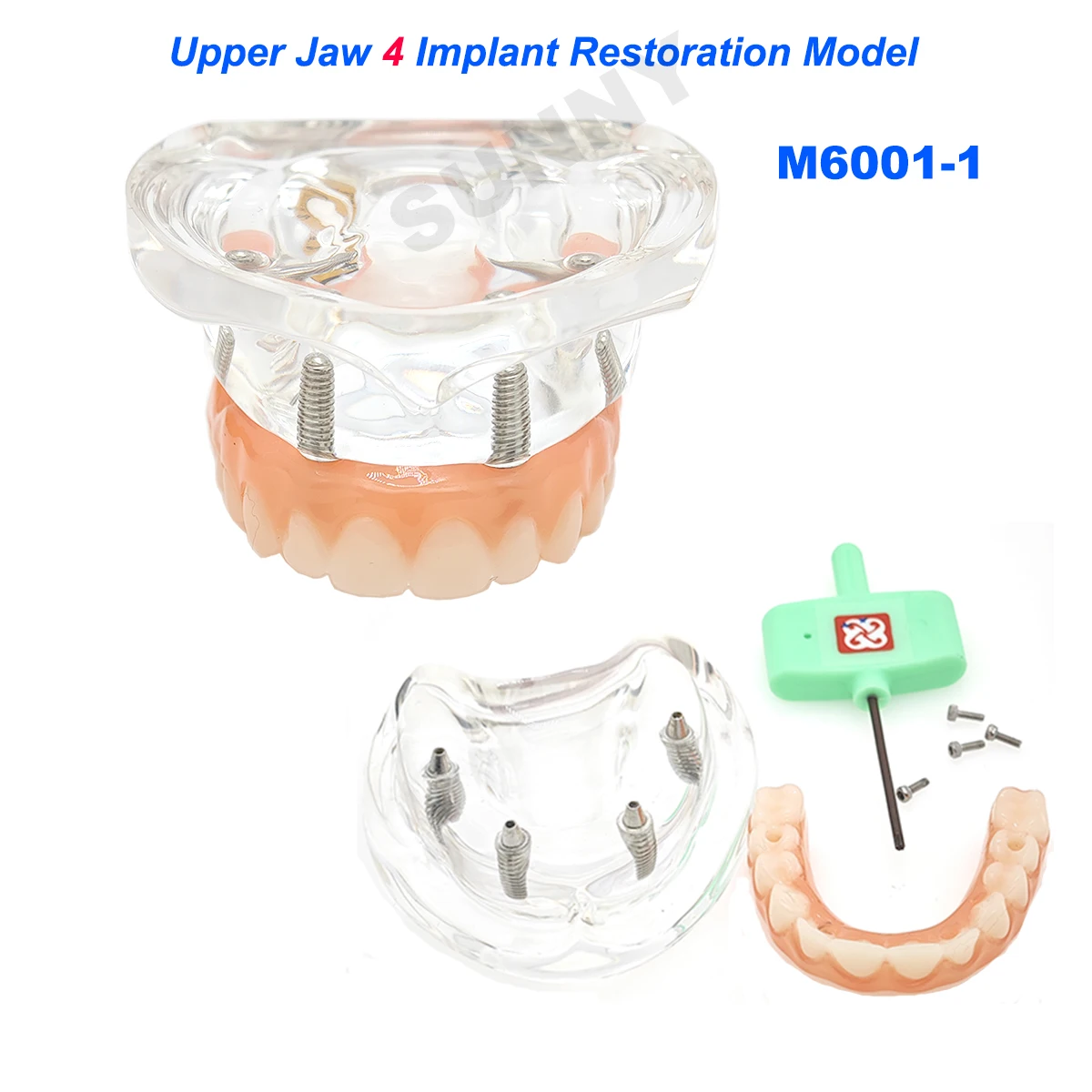 Dental Teeth Model simulation Transparent Upper Jaw Implant Restoration 4 Screws with Post Core Bridge Dentist Teaching Studying