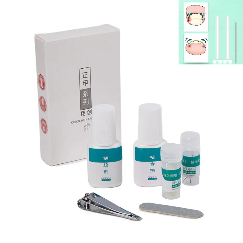 ペディキュア、埋め込み式つま先ネイルトリートメント用のingrown toenailは、プロのingrown toenail補正、フットケアツール