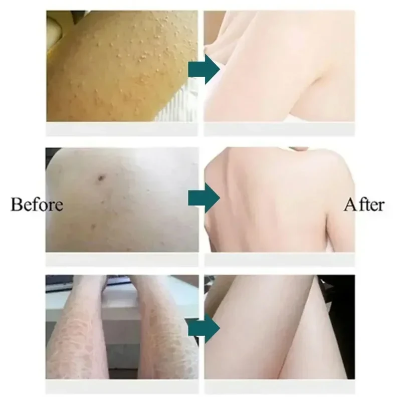 Kräuter Anti-Riss Fuß creme Ferse Cracking Reparatur produkte Peeling abgestorbene Haute ntfernung Erweichung befeuchten glatte Hautpflege