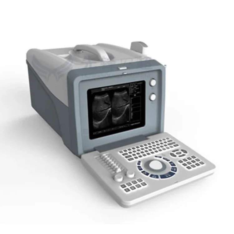 Custom Design XF218 Full Digital Portable Machine Wireless Fetal Ultrasound Scanner