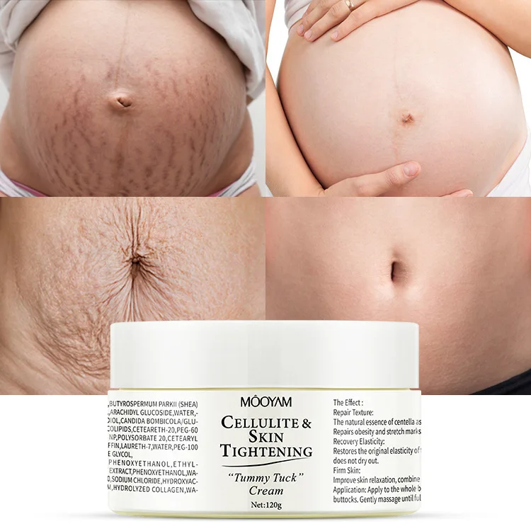 

Stretch Mark Cream Fat Body Pattern Care Cream Firming Nourishing Fading Postpartum Pregnancy Pattern Repair Cream Skincare