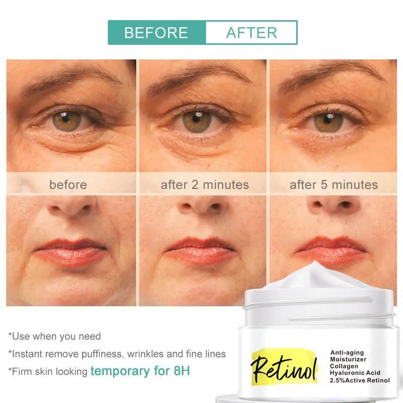 Actieve Retinol Gezichtscrème Anti Rimpel Gezichtscrème Collageen Hyaluronzuur Krimpen Poriën Verstevigende Crème Verbeteren