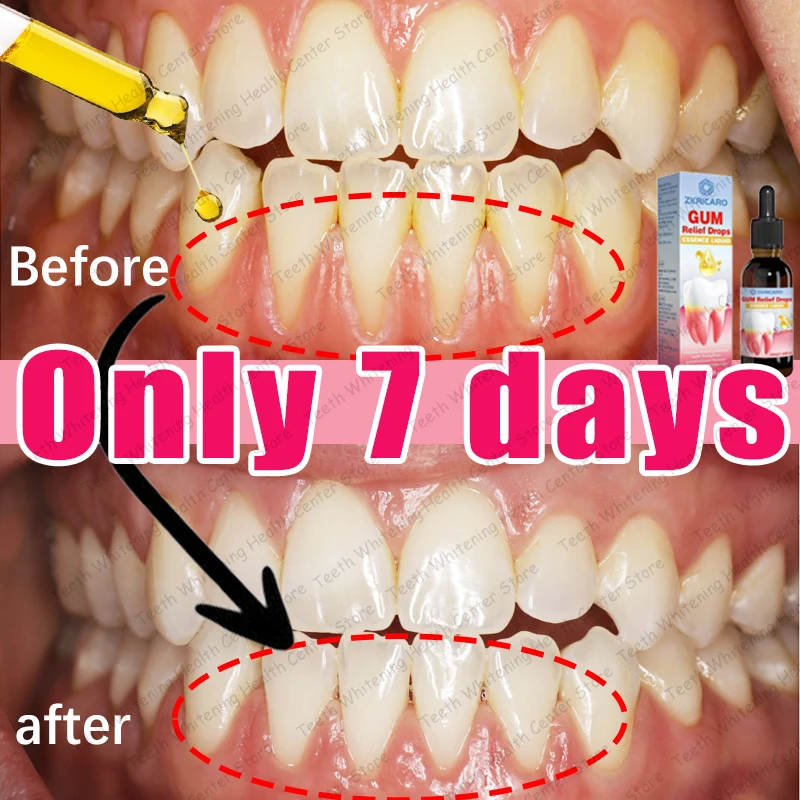 

Восстановить открытые десны и дайте вас уверенную улыбку