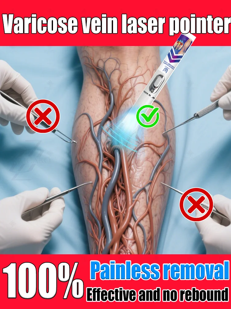 

Reverse leg health in 7 days and say goodbye to varicose vein recurrence