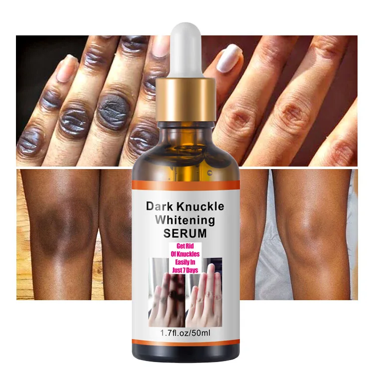 

50g Get Rid Of Dark Knuckles In 7 Days Serum Whitening Removing Dark knuckles Serum Hand knuckle Eraser Serum for Elbow and Knee