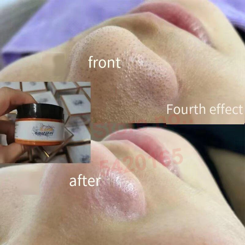 Plant 100g Deep Cleansing Balm Color Correcting Cream Pore Dirt Remover Blackhead Eraser  Makeup Melting Cream Redness Relief