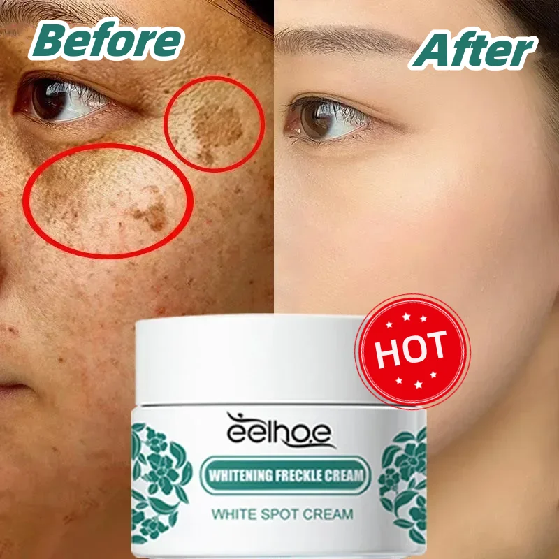 Niacinamide Melasma Brightening Cream Whitening Freckle Cream Reduce Melanin Lighten Dark Spot Fade Fine Lines Skin Care Product