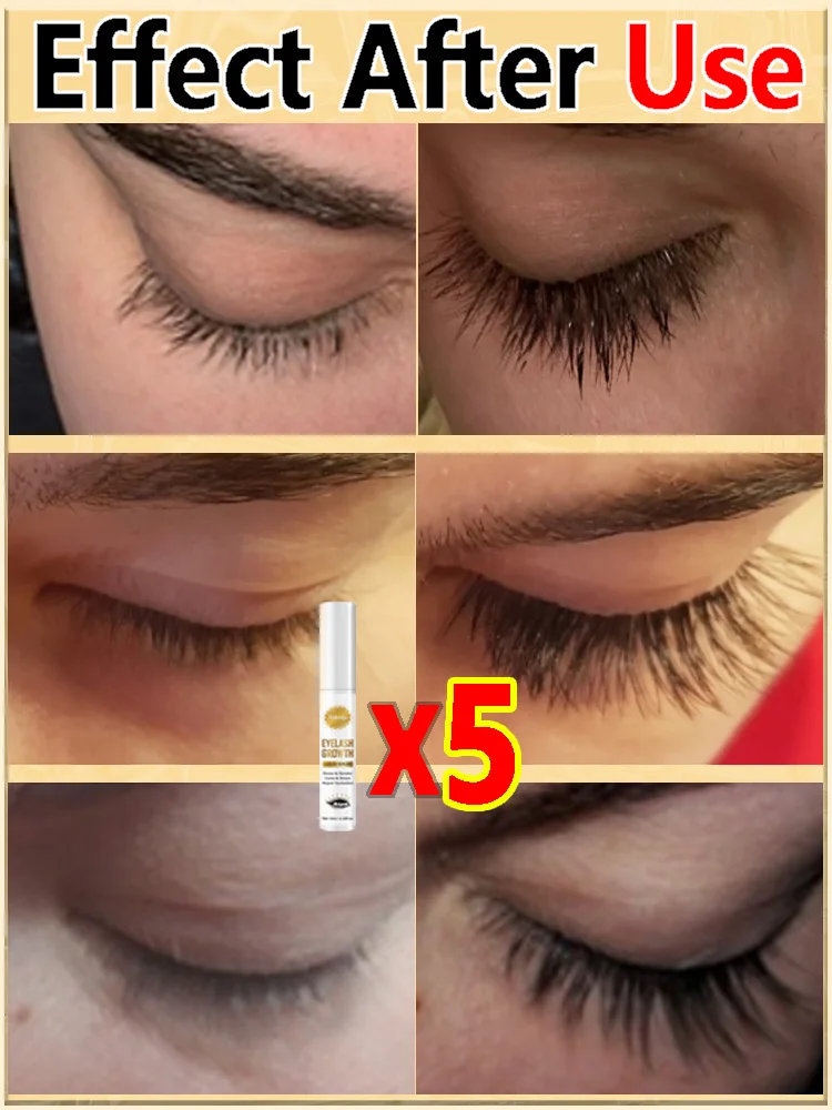 Eyelash rapid growth serum, make eyelashes darker and longer