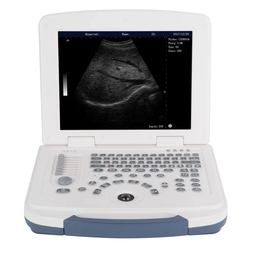 

Low Price High Quality Portable Ultrasound Scanner MINI Fibroscan Machine With Printer