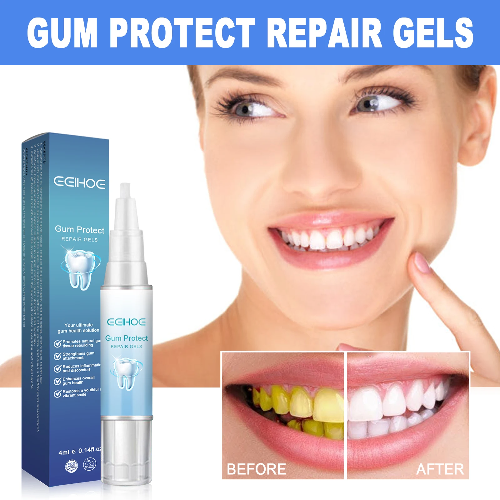 Aloe Vera Teeth Whitening Gel to Remove Dental Calculus.Reduce Gum Sensitivity.Gentle Formula Remove Pigmentation Oral Care Gel