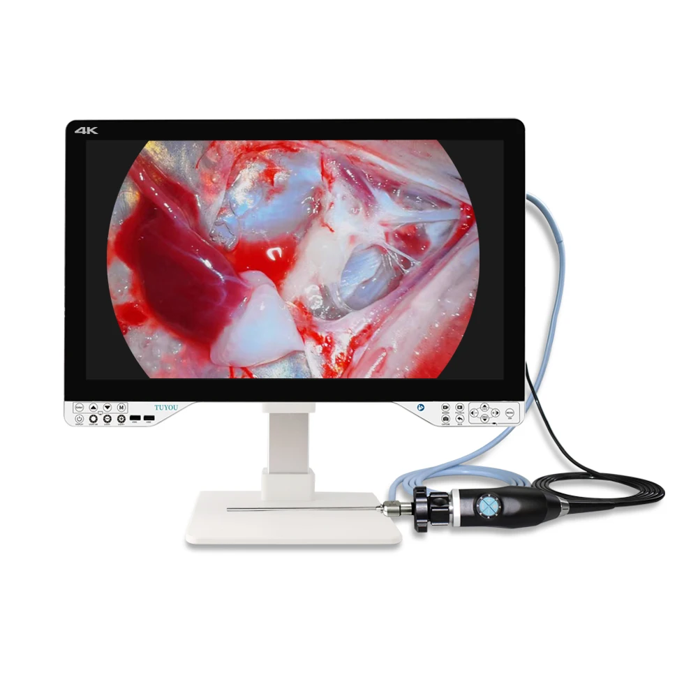 27inch 1080P Full HD 5 in 1 Medical Endoscope Camera Arthroscope System With Surgical Arthroscopy Laparoscopy Cystoscope