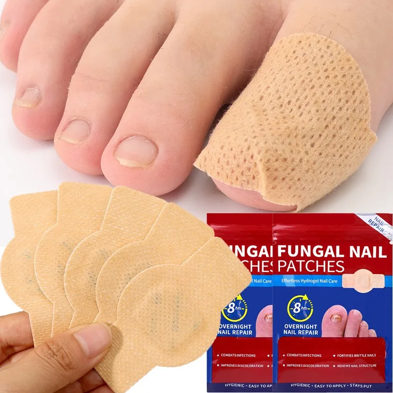 21-105pcs Fungo per unghie Patch Correzione incarnita impermeabile Toppe per unghie grigie danneggiate Adesivi per il trattamento dell'unghia del piede Strumento per la cura dei piedi
