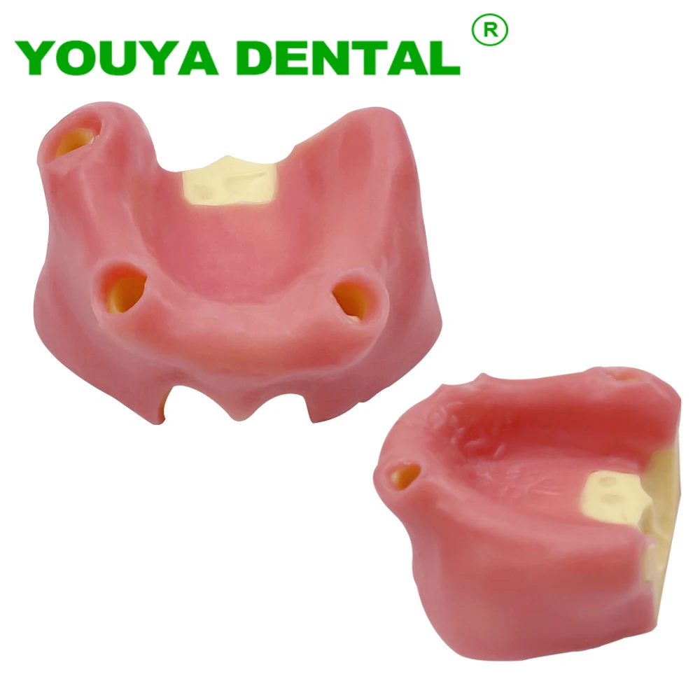 

Dental Implant Practice Model No Tooth Maxillary Sinus With Soft Gums Dentistry Demonstration Oral Model Dental Laboratory Model