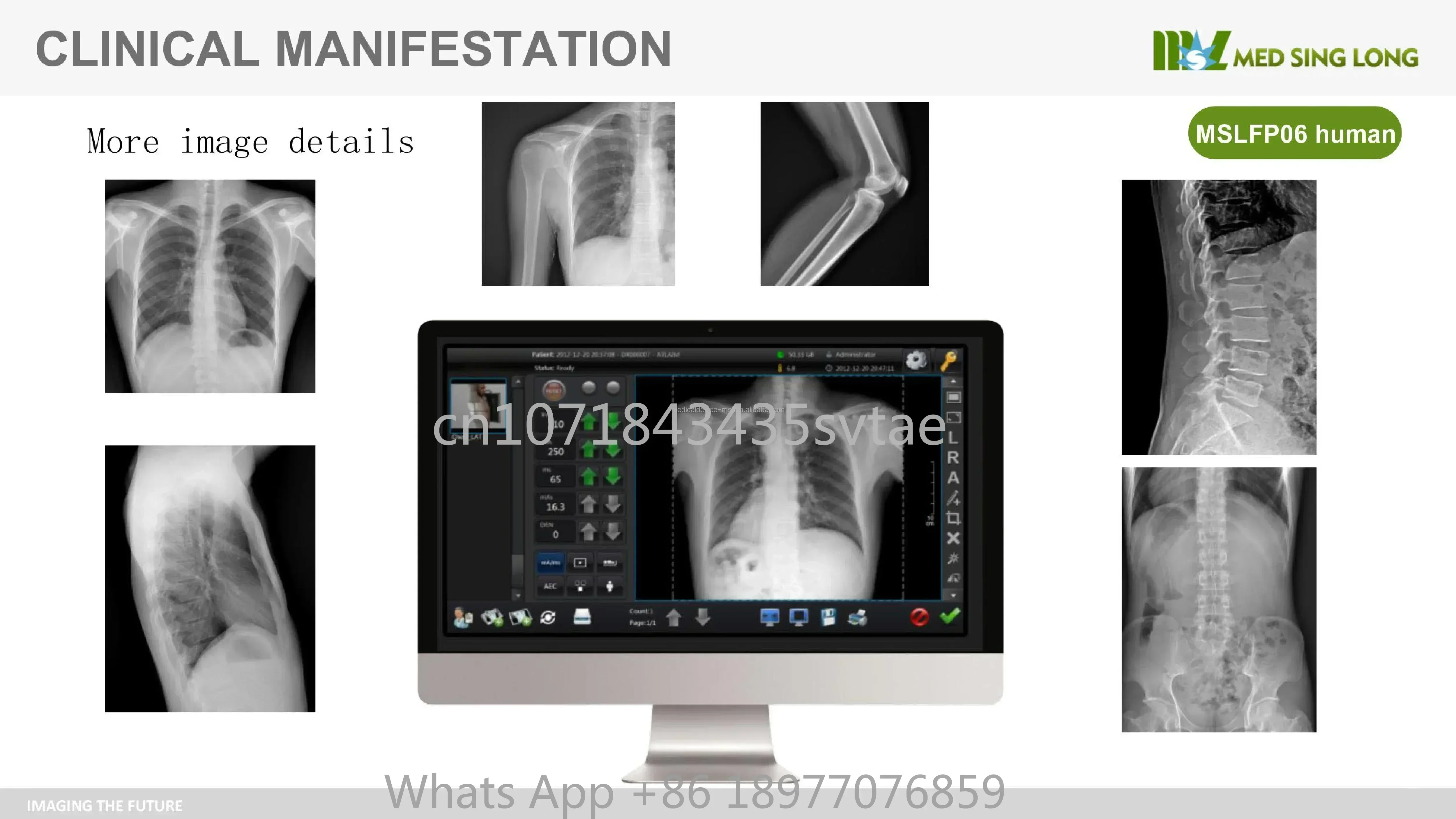 حار بيع مستشفى كاشف اللوحة المسطحة اللاسلكية 17*17 لوحة مسطحة X راي للإنسان والطب البيطري