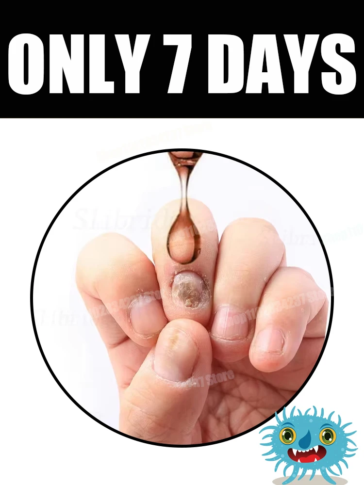 Ringiovanitore - Tecnologia di prevenzione dei funghi - Controllo e sensore di sicurezza regolabili69