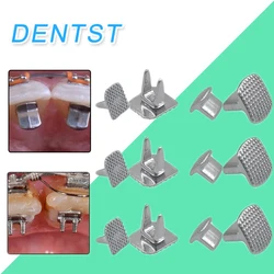 10pcs Dental Tongue Tamer Orthodontic Lingual ButtoMonoblock Bite Opener Metal Stopper Single Wing Builder Bondable Hinge spikes