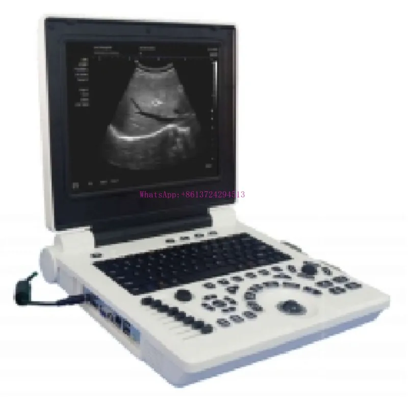 Full Digital LED Professional Diagnostic Ultrasound System Black and White Portable  Scanner Machine For Hospital