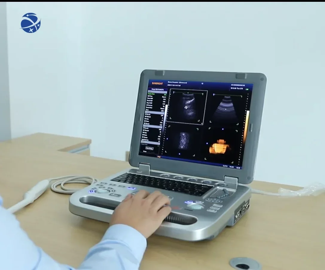 Best price  laptop ultrasound machine/Hand-carried Portable 3D 4D Color Ultrasound Doppler for hospital