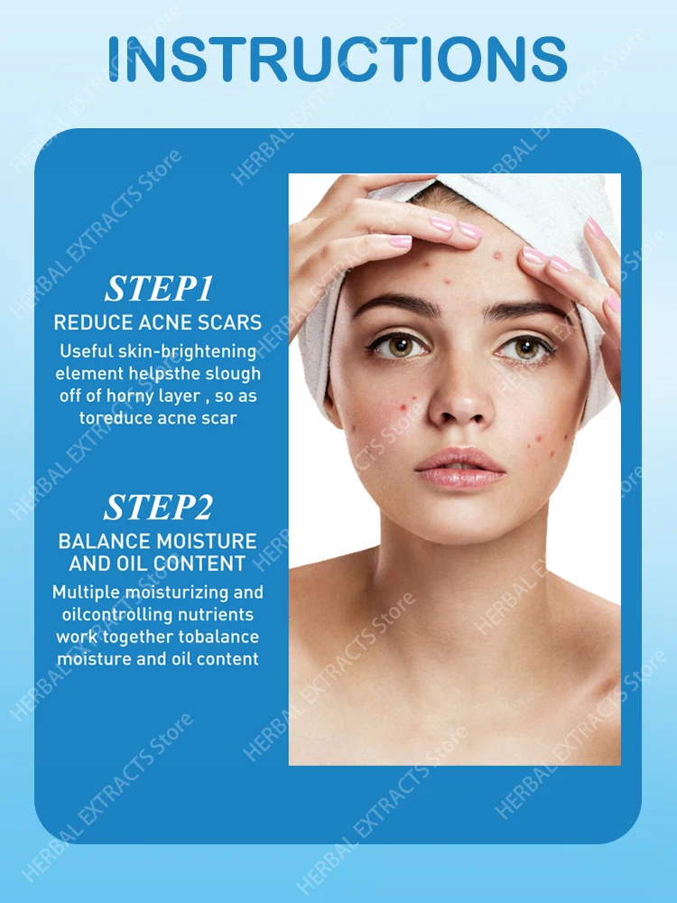 Acne Skin Care